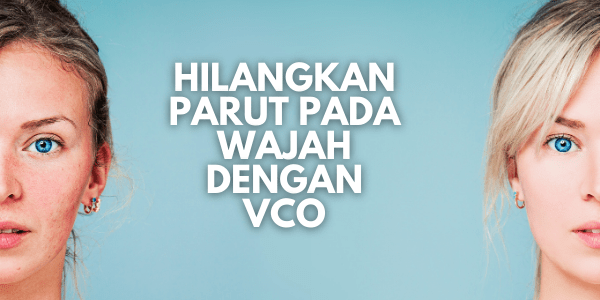 20 KHASIAT MINYAK KELAPA DARA KEPADA KESIHATAN DAN KECANTIKAN D'Aura D'Aura 18